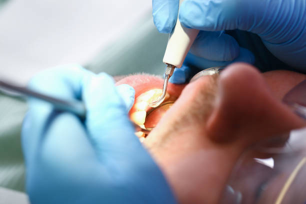Best Emergency Dental Care for Sports Injuries in Culloden, WV